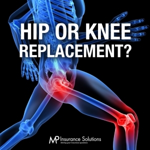 Hip or Knee Replacements